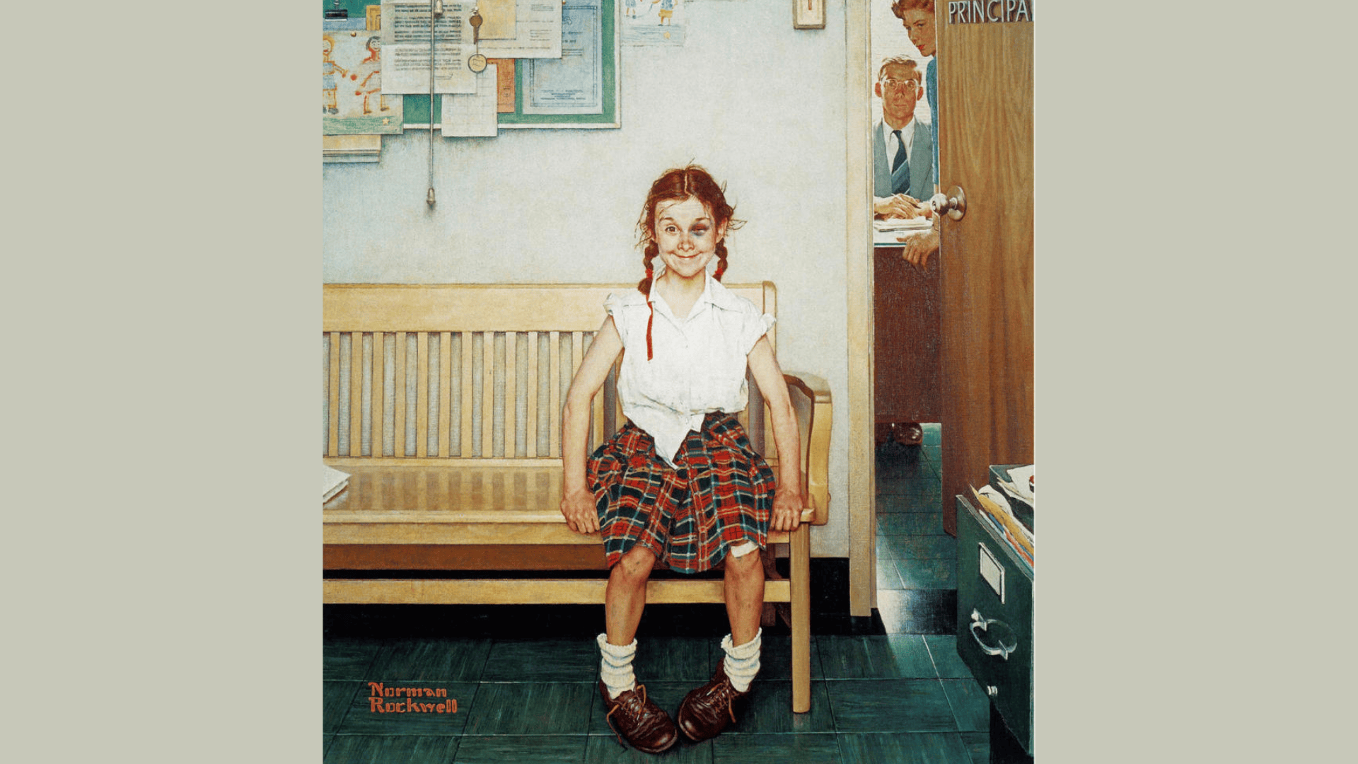 the young lady with the shiner